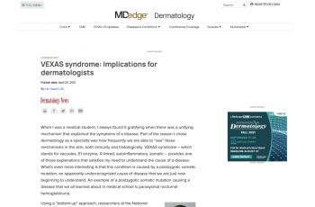 Preview of web article on mdedge.com, "VEXAS syndrome: Implications for dermatologists"